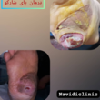 تصویر 2 کلینیک درمان زخم و زیبایی دکتر علی نویدی