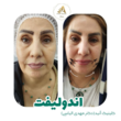 تصویر 4 کلینیک پوست و زیبایی آنید   