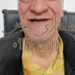 تصویر 1 دندانسازی مومن