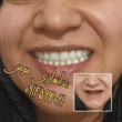 تصویر 6 دندانسازی مومن