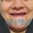 تصویر 7 دندانسازی مومن