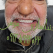 تصویر 10 دندانسازی مومن