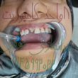 تصویر 26 دندانسازی مومن
