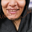 تصویر 29 دندانسازی مومن