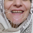 تصویر 31 دندانسازی مومن