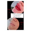 تصویر 5 سالن زیبایی سارا اشراقی