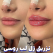 تصویر 2 مرکز زیبایی و سولاریوم رها بیوتی