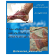 تصویر 9 مرکز درمانی زخم و ازون تراپی نیاوران