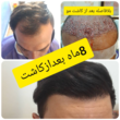 تصویر 1 مرکز زیبایی کالیستو (کاشت مو)
