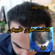 تصویر 2 مرکز زیبایی کالیستو (کاشت مو)