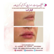 تصویر 12  کلینیک پوست و مو دکترفهیمه اکبری طامه