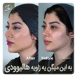 تصویر 1 کلینیک زیبایی شی 