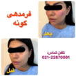 تصویر 2 کلینیک جراحی زیبایی ماه طلایی