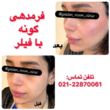 تصویر 3 کلینیک جراحی زیبایی ماه طلایی