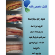 تصویر 1 کلینیک زخم پاشنه