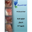 تصویر 6 کلینیک زخم پاشنه