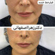 تصویر 15 کلینیک لیزر و زیبایی ونوس (دکتر زهرا اصفهانی)