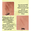 تصویر 3 مرکز لیزر باران