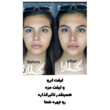 تصویر 6 سالن زیبایی گلارا بیوتی