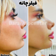 تصویر 2 مرکز زیبایی و لاغری باران