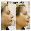 تصویر 4 مرکز زیبایی و لاغری باران