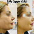 تصویر 6 مرکز زیبایی و لاغری باران