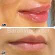تصویر 7 مرکز زیبایی و لاغری باران