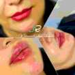 تصویر 6 کلینیک زیبایی پوست و لیزر دکتر محمدصادق رمضانی