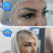 تصویر 4  کلینیک لیزر و زیبایی اَفرا 