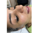 تصویر 4 فیشال تخصصی و پاکسازی عمقی پوست نفیس