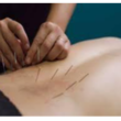 تصویر 4 کلینیک طب سوزنی دکتر اشرف واثق نیا