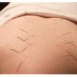 تصویر 5 کلینیک طب سوزنی دکتر اشرف واثق نیا