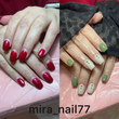 تصویر 7 کاشت ناخن میرا