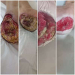 تصویر 4 درمانگر زخم دانیال مدبری