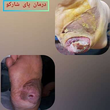 تصویر 1 کلینیک درمان زخم  دکتر علی نویدی