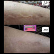 تصویر 5 کلینیک درمان زخم  دکتر علی نویدی