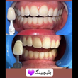 تصویر 3 کلینیک دندانپزشکی و زیبایی زهره (شعبه چیتگر)