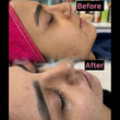 تصویر 5 فشیال تخصصی و جوانسازی پوست سمیرا شیدایی