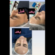 تصویر 6 فشیال تخصصی و جوانسازی پوست سمیرا شیدایی
