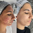 تصویر 7  مرکز تخصصی مرکز فیشیال  شیدی اسکین 