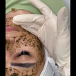 تصویر 8  مرکز تخصصی مرکز فیشیال  شیدی اسکین 