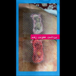تصویر 1 آیدا علیزاده درمانگر زخم