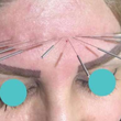تصویر 1 کلینیک طب سوزنی و طب سنتی دکتر بهنام