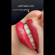تصویر 11 بهترین سالن زیبایی و آرایشگاه زنانه کیمیا