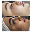 تصویر 5 مرکز تخصصی فیشال وآبرسانی پوست نرگس