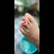 تصویر 3 دانیال صمدی کارشناس زخم و استومی