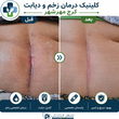 تصویر 2 کلینیک درمان زخم و دیابت مختاری