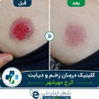 تصویر 3 کلینیک درمان زخم و دیابت مختاری