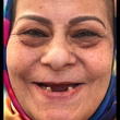 تصویر 1 دندانساز و پروتز متحرک مدرن اشرفی