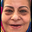 تصویر 2 دندانساز و پروتز متحرک مدرن اشرفی